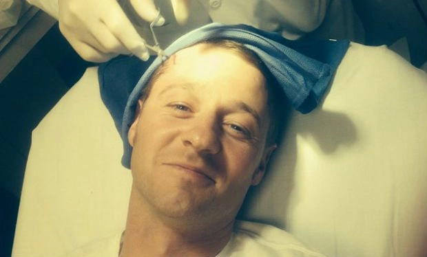 Ben_McKenzie_suffers_head_injury_on_the_set_of_Batman_prequel_Gotham
